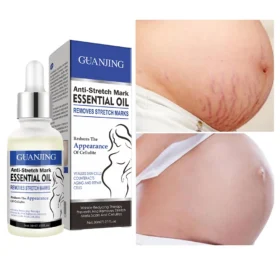 Repairing Stretch Mark Removal Essential Oil 30ml