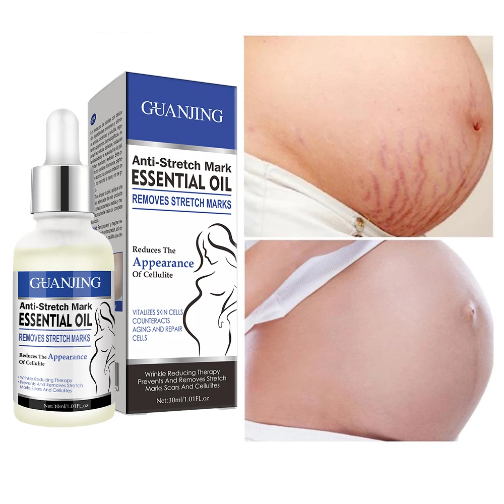 Repairing Stretch Mark Removal Essential Oil 30ml