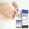 Repairing Stretch Mark Removal Essential Oil 30ml